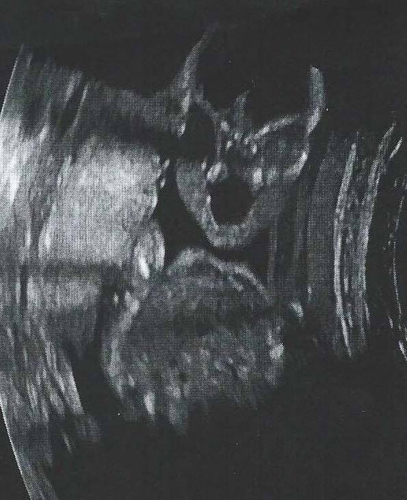 Scary ultrasound photo