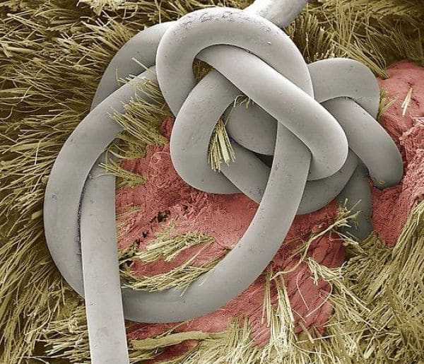 Sutured wound, SEM